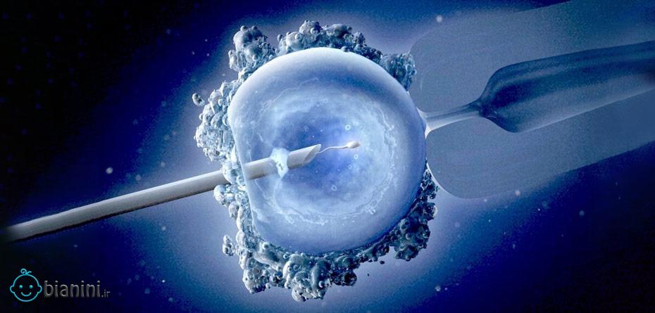 آی وی اف (IVF)، از شایعه تا واقعیت