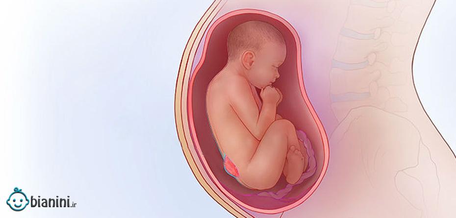اسپینا بیفیدای جنین چیست و چگونه درمان می‌شود؟