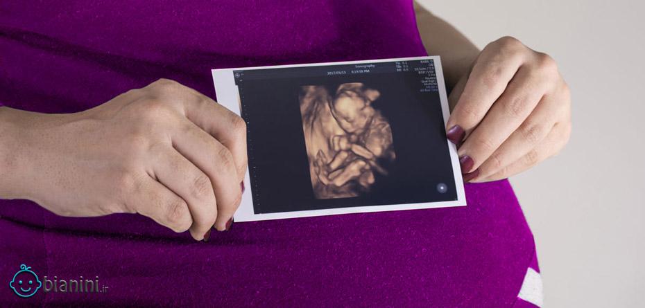 اندام‌های جنین چه زمانی شکل می‌گیرد؟