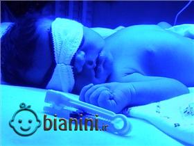 بچه‌های‌ پاییزی؛ اطلاعاتی درباره زردی در نوزادان