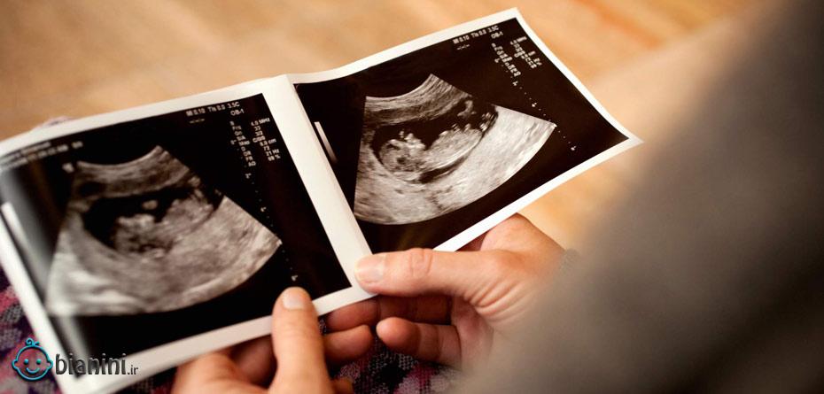 درباره کرونا و تاثیر آن بر جنین چقدر می‌دانیم؟