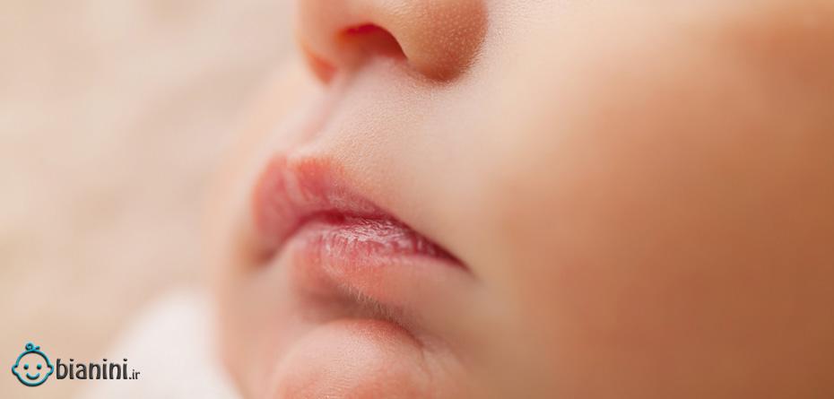 درمان خشکی لب کودک، با چند راهکار ساده