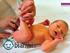 راه های درمان زردی نوزادان + علت، علائم و راه های تشخیص آن