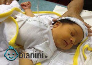 علت زردی نوزادان در هنگام تولد چیست + عوامل خطرساز و تشدید کننده زردی نوزادان