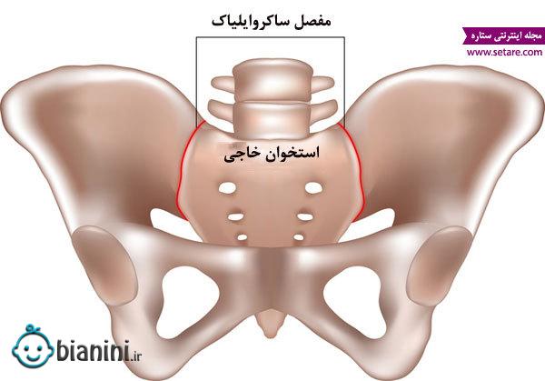 کمر درد در بارداری - عکس مفصل ساکروایلیاک - درمان کمر درد