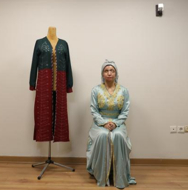 مدلینگ لباس؛ شغل جدید قربانی اسیدپاشی در ایران
