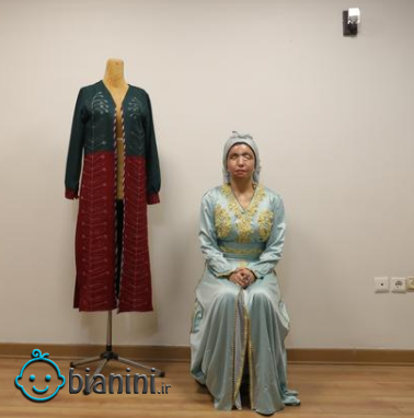 مدلینگ لباس؛ شغل جدید قربانی اسیدپاشی در ایران