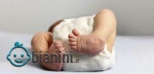 پاچنبری نوزاد چیست و چگونه درمان می‌شود؟