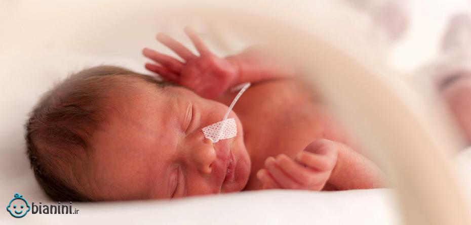 کامل نشدن ریه نوزاد خطرناک است؟